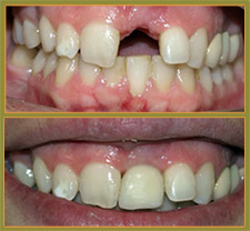 BEFORE & AFTER TREATMENT