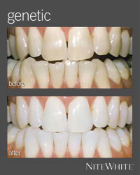 Genetic